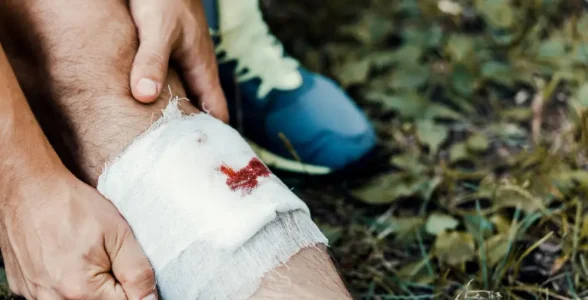 A cut knee being bandaged by the 4JH trainers to show the first aid that they can provide.